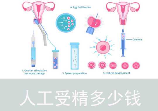 人工受精多少钱插图