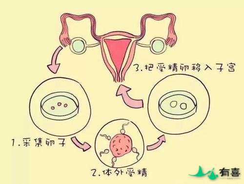 马来西亚第三代试管婴儿适合哪些人插图